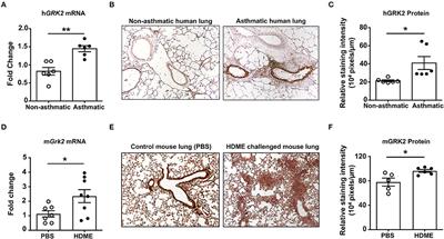 G Protein-Coupled Receptor Kinase 2 (GRK2) Regulates T Cell Response in a Murine Model of House Dust Mite-Induced Asthma